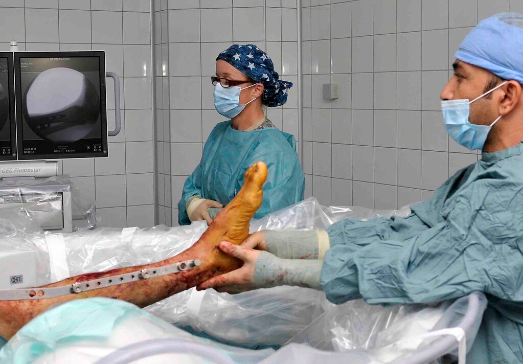 ‘Massa de osso’ impressa em 3D pode acelerar recuperação de fraturas em humanos e animais